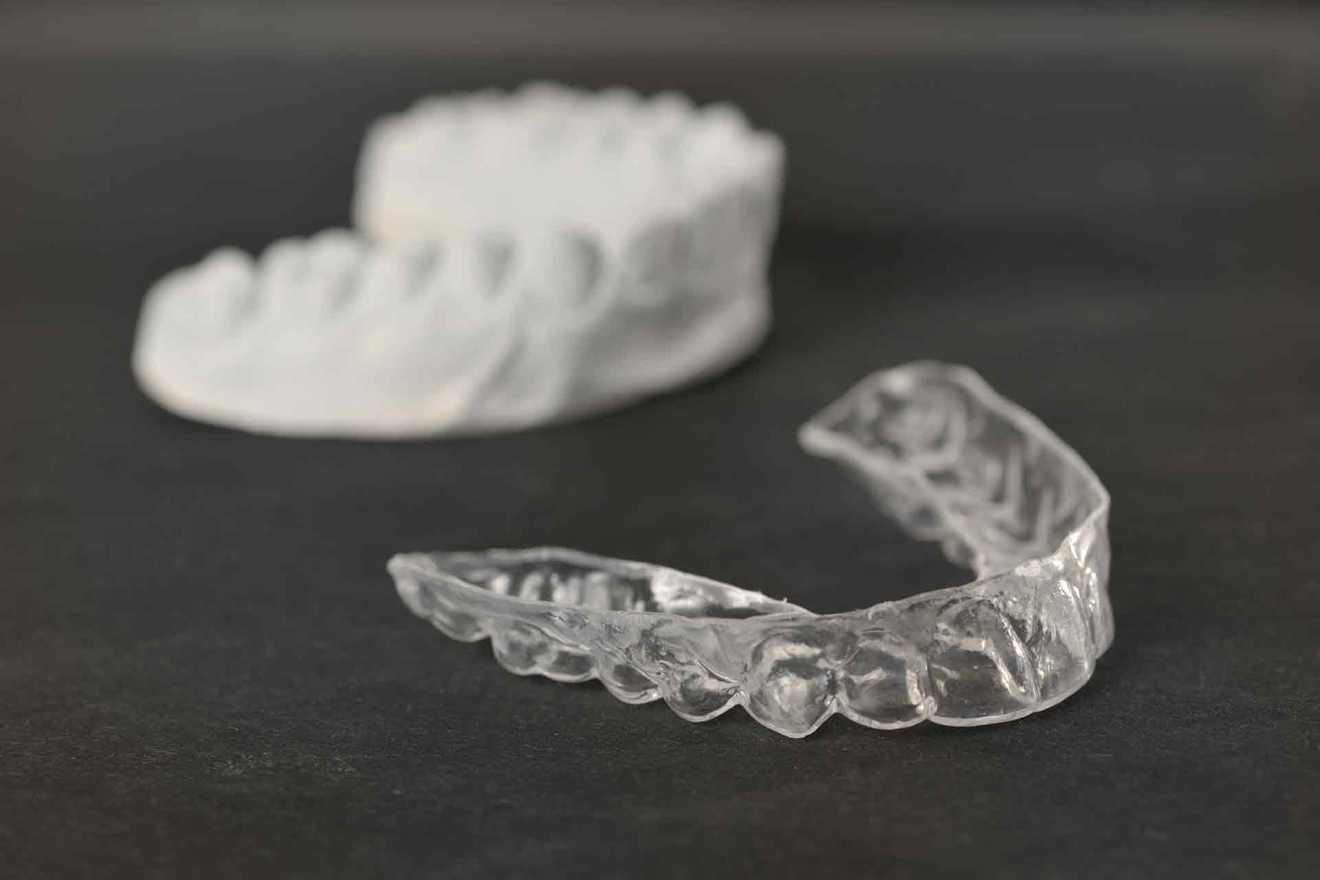 What are the Benefits of Invisalign?
